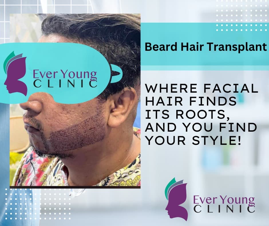 Beard hair transplant result showing restored facial hair density at Ever Young Clinic